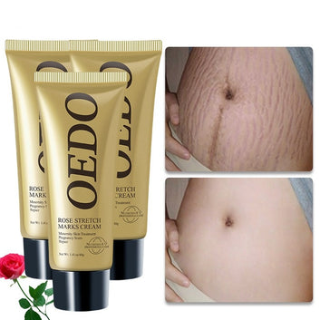 3pcs Rose Remove Stretch Marks Cream